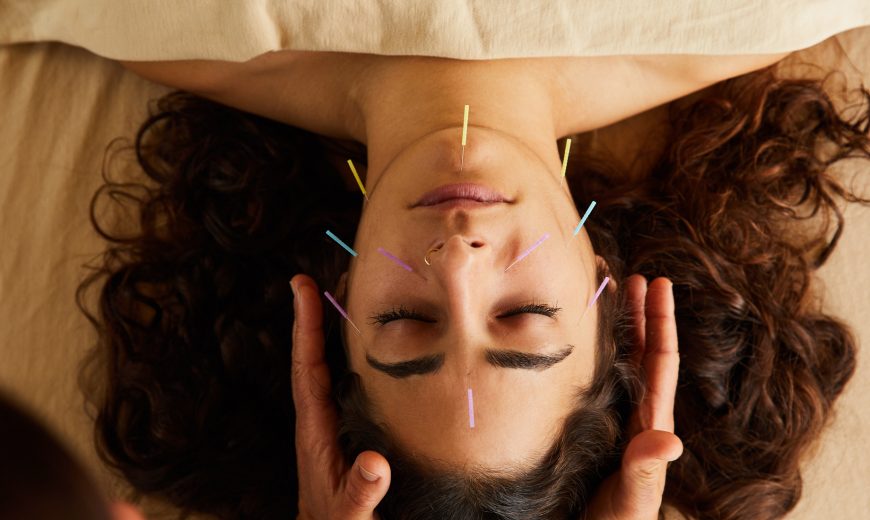 A Sanctuary Body acupuncture client rests peacefully